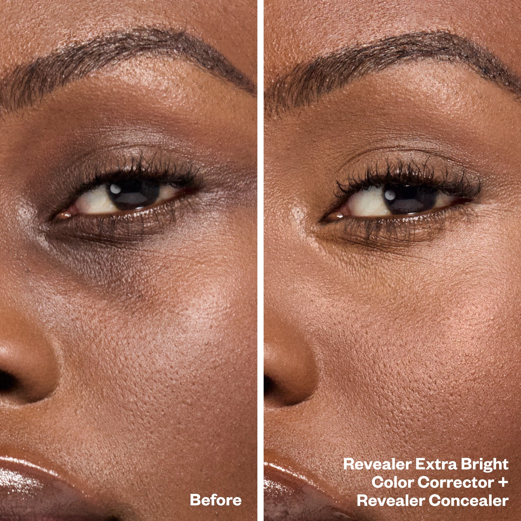 Bright Eyes Set Secondary image